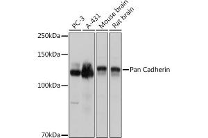 Western blot analysis of extracts of various cell lines, using Pan Cadherin antibody (ABIN7266233) at 1:3000 dilution. (CDH1,CDH2,CDH3,CDH4 (AA 800-882) Antikörper)