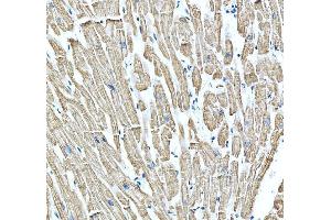 IHC analysis of MYH3 using anti-MYH3 antibody (ABIN7601735).