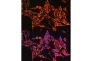 Immunofluorescence analysis of HeLa cells using MT- antibody (ABIN7268594) at dilution of 1:100. (Mitochondrially Encoded ATP Synthase 8 (MT-ATP8) Antikörper)