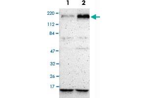 Western Blot analysis of Lane 1: RT-4 and Lane 2: U-251MG sp cell lysates with BRIP1 polyclonal antibody . (BRIP1 Antikörper)