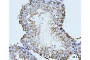 IHC analysis of GHITM using anti-GHITM antibody (ABIN7599294). (GHITM Antikörper  (AA 1-345))