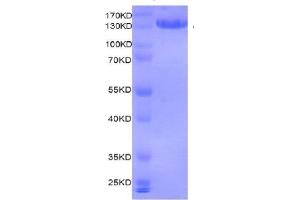 Recombinant MMSET / WHSC1 protein gel.