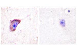Immunohistochemistry (IHC) image for anti-Tyrosine Hydroxylase (TH) (pSer19) antibody (ABIN1847228) (Tyrosine Hydroxylase Antikörper  (pSer19))