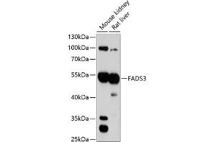 Western blot analysis of extracts of various cell lines, using F antibody (ABIN1679802, ABIN3018325, ABIN3018326 and ABIN6220437) at 1:3000 dilution. (FADS3 Antikörper  (AA 1-130))