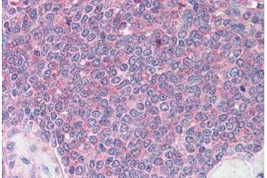 Spleen: Formalin-Fixed, Paraffin-Embedded (FFPE) (DDX3X Antikörper  (Internal Region))