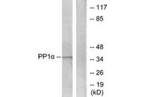 Western Blotting (WB) image for anti-Protein Phosphatase 1, Catalytic Subunit, alpha Isoform (PPP1CA) (AA 281-330) antibody (ABIN2888749) (PPP1CA Antikörper  (AA 281-330))
