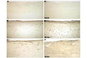 Sections of cartilage, showing immnostaining for galectin-3 from normal (A-C) and osteoarthritic cartilage (D-F). (Galectin 3 Antikörper  (N-Term))
