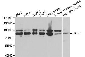 Western blot analysis of extracts of various cell lines, using CARS antibody. (CARS Antikörper)