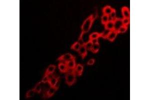Immunofluorescent analysis of Adenosine A2a Receptor staining in LOVO cells. (Adenosine A2a Receptor Antikörper  (C-Term))
