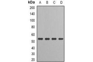 Western blot analysis of IRF-6 expression in HT29 (A), MCF7 (B), mouse kidney (C), rat liver (D) whole cell lysates. (IRF6 Antikörper)
