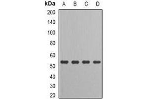 Western blot analysis of IRF-6 expression in HT29 (A), MCF7 (B), mouse kidney (C), rat liver (D) whole cell lysates.