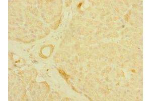 Immunohistochemistry of paraffin-embedded human pancreatic tissue using ABIN7158910 at dilution of 1:100 (MPP6 Antikörper  (AA 220-420))