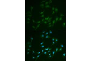 Immunofluorescence analysis of MCF7 cell using LIG1 antibody. (LIG1 Antikörper)