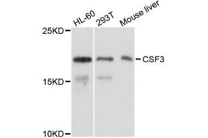 Western blot analysis of extracts of various cell lines, using CSF3 antibody (ABIN1882310) at 1:1000 dilution. (G-CSF Antikörper)