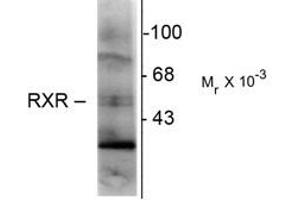 Image no. 1 for anti-Retinoid X Receptor, gamma (RXRG) antibody (ABIN303926) (Retinoid X Receptor gamma Antikörper)