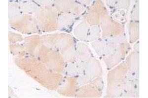 IHC-P analysis of Mouse Skeletal Muscle Tissue, with DAB staining. (Thrombospondin 1 Antikörper  (AA 515-671))