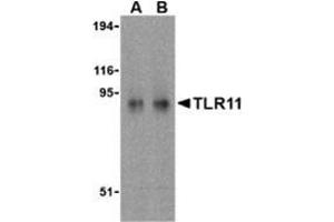 Western blot analysis of TLR11 in RAW264. (TLR11 Antikörper  (C-Term))