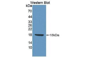 Western blot analysis of the recombinant protein. (FLRT3 Antikörper  (AA 29-152))