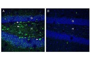 Expression of Netrin-1 in mouse hippocampus. (Netrin 1 Antikörper  (Secreted))
