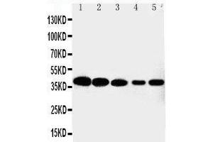 Anti-Cdk7 antibody,  Western blotting Lane 1: HELA Cell Lysate Lane 2: MCF-7 Cell Lysate Lane 3: A549 Cell Lysate Lane 4: COLO320 Cell Lysate Lane 5: JURKAT Cell Lysate (CDK7 Antikörper  (C-Term))