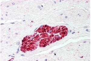 Human Prostate, Nerve (formalin-fixed, paraffin-embedded) stained with S100 Protein antibody ABIN214427 at 2. (S100 Protein (S100) Antikörper)