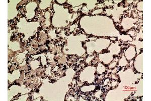 Immunohistochemistry (IHC) image for anti-Nuclear Factor (erythroid-Derived 2)-Like 2 (NFE2L2) (acLys599) antibody (ABIN3188008)