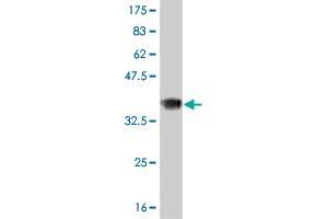Western Blot detection against Immunogen (36. (Recoverin Antikörper  (AA 101-199))