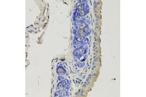Immunohistochemistry of paraffin-embedded mouse lung using GPHN antibody (ABIN5996450) at dilution of 1/100 (40x lens). (Gephyrin Antikörper)