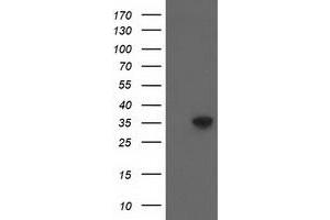 HEK293T cells were transfected with the pCMV6-ENTRY control (Left lane) or pCMV6-ENTRY ACY3 (Right lane) cDNA for 48 hrs and lysed. (Aminoacylase 3 Antikörper)