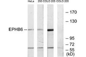 Western blot analysis of extracts from COLO/293/HeLa cells, using EPHB6 Antibody. (EPH Receptor B6 Antikörper  (AA 861-910))