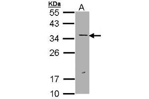 Western Blotting (WB) image for anti-Excision Repair Cross Complementing Polypeptide-1 (ERCC1) (AA 47-272) antibody (ABIN467448) (ERCC1 Antikörper  (AA 47-272))