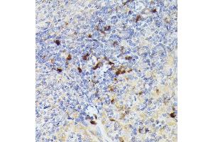 Immunohistochemistry (IHC) image for anti-Cathepsin G (CTSG) (AA 21-255) antibody (ABIN6139229)