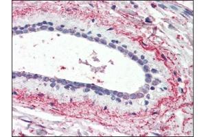 Human Breast (formalin-fixed, paraffin-embedded) stained with WNT3at 3. (WNT3 Antikörper  (Internal Region))