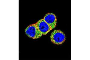 Confocal immunofluorescent analysis of AKT2 Antibody (N-term) (ABIN391021 and ABIN2841191) with Hela cell followed by Alexa Fluor 488-conjugated goat anti-rabbit lgG (green).