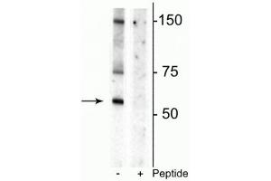 Western blot of rat striatal lysate showing specific immunolabeling of the ~55 kDa glycosylated form of the DAT protein phosphorylated at Thr53 in the first lane (-).