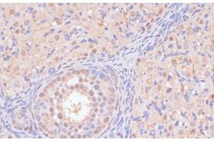 Immunohistochemistry of paraffin-embedded Rat ovary using BYSL Polyclonal Antibody at dilution of 1:100 (40x lens). (Bystin-Like Antikörper)