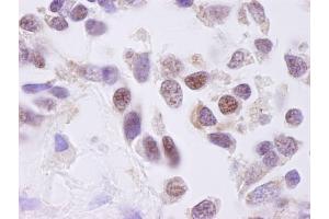 Immunohistochemistry (IHC) image for anti-Casein Kinase 2 alpha 1 (CSNK2A1) (AA 300-350) antibody (ABIN7448478)