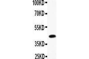 Anti- CEBP Beta Picoband antibody, Western blotting All lanes: Anti CEBP Beta  at 0. (CEBPB Antikörper  (AA 1-200))