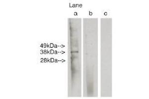 Image no. 1 for anti-Ceramide Synthase 6 (CERS6) antibody (ABIN4620354) (CERS6 Antikörper)
