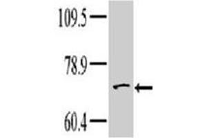 Western blot analysis of TNK1 polyclonal antibody  in HeLa cell line lysate. (TNK1 Antikörper  (Internal Region))