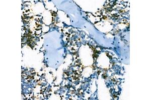 Immunohistochemistry of paraffin embedded mouse bone using AHSP (ABIN7073016) at dilution of 1:300 (400x lens) (aHSP Antikörper)