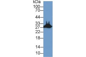 Western Blot; Sample: Mouse Skeletal muscle lysate; Primary Ab: 2µg/ml Rabbit Anti-Human STC2 Antibody Second Ab: 0. (Stanniocalcin 2 Antikörper  (AA 53-294))