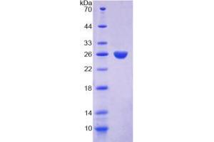 SDS-PAGE (SDS) image for Proteinase 3 (PRTN3) (AA 18-246) protein (His tag) (ABIN1171240)