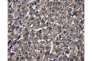 Immunohistochemical staining of paraffin-embedded liver tissue using anti-BRAFmouse monoclonal antibody. (BRAF Antikörper)