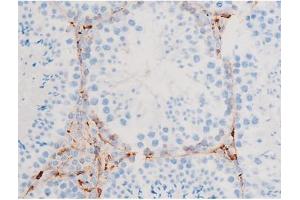 Immunohistochemistry (IHC) image for anti-Spleen tyrosine Kinase (SYK) (pTyr348) antibody (ABIN6255895)