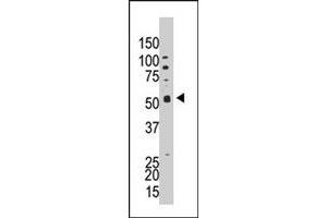 The PPP5C polyclonal antibody  is used in Western blot to detect PPP5C in HL-60 cell lysate. (PP5 Antikörper  (C-Term))