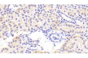 Detection of FPN in Human Kidney Tissue using Polyclonal Antibody to Ferroportin (FPN) (SLC40A1 Antikörper  (AA 127-321))