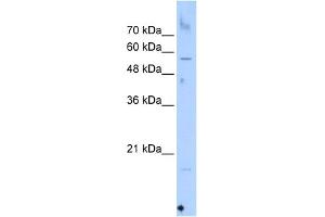 WB Suggested Anti-SEPN1 Antibody Titration:  0. (SEPN1 Antikörper  (C-Term))
