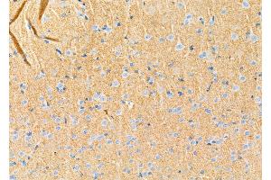 ABIN6264742 and ABIN6272414 at 1/100 staining Rat brain tissue by IHC-P.