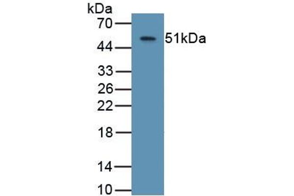Aspartate beta Hydroxylase Antikörper  (AA 345-758)